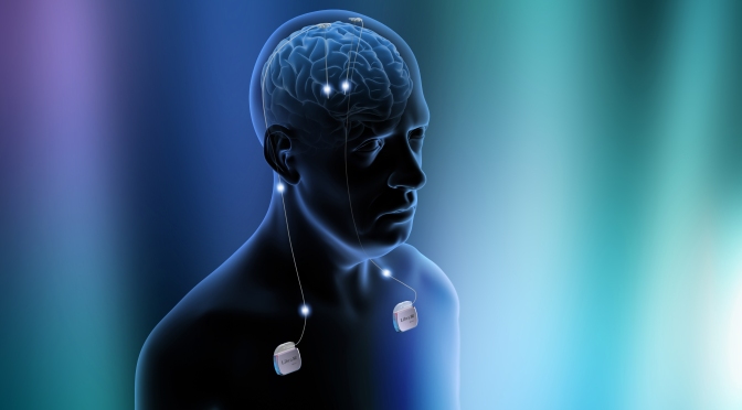 Connections: the core of ‘thinking’ – Deep Brain Stimulation